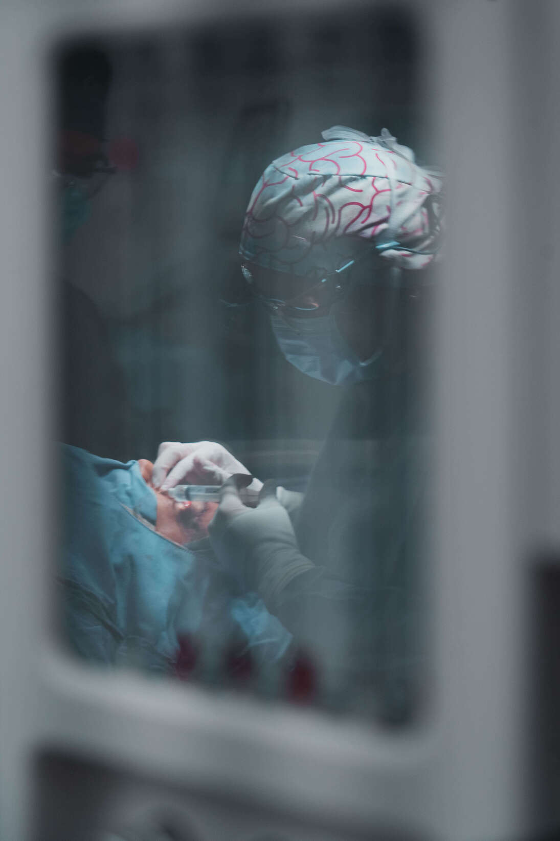 Cirugía de blefaroplastia y oculoplastia realizada por la Dra. Linda Espinosa en Medellín